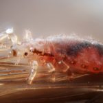 Safe and Effective Ways to Get Rid of Head Lice