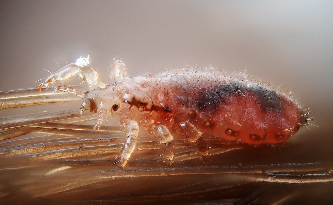 Safe and Effective Ways to Get Rid of Head Lice - Lawnstarter