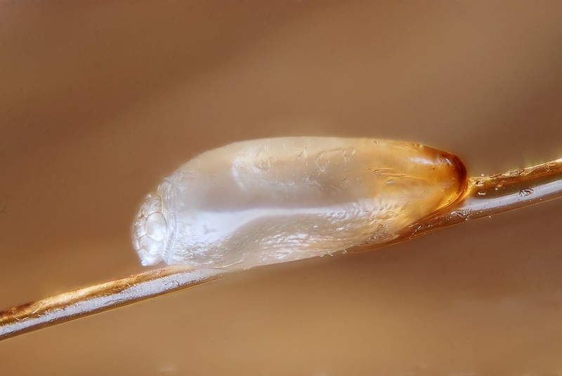 Louse egg on a human hair