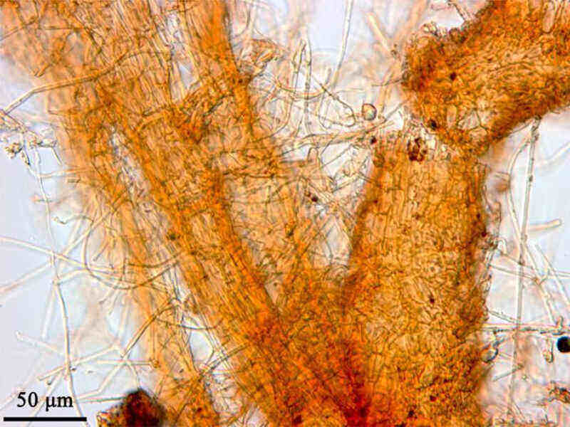  Phymatotrichum root rot 