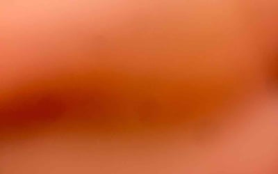 Photo of Lynnette M.'s yard after getting tree care in San Jose, CA